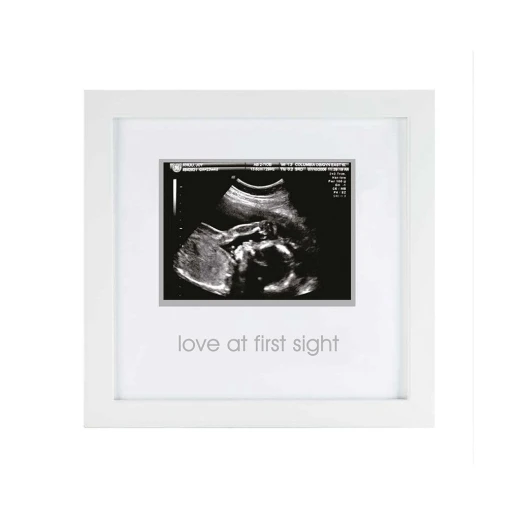 PearHead Frame Sonogram, White PearHead Frame Sonogram, White