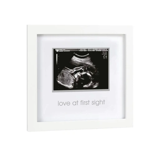 PearHead Frame Sonogram, White - بيرهيد - Image 3