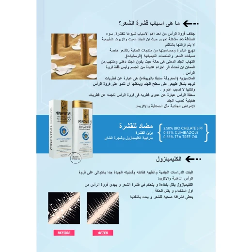 شامبو الشعر المحجبات 300 مل من مينيفيتال ، - مينيفيتال - Image 4