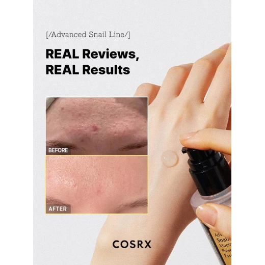 خلاصة قوة الحلزون المتطورة من Cosrx، 96 موسين، 100 مل، مصل مرطب للوجه - كوسركس - Image 4