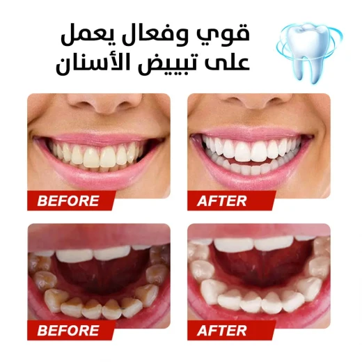 معجون أسنان فعال لإزالة البقع للحصول على ابتسامة أكثر إشراقًا - Image 3