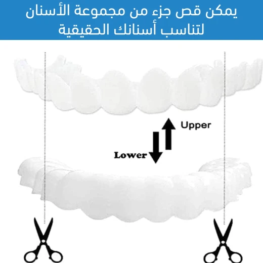 طقم فينير الأسنان المثالي, تغطية كاملة علوية وسفلية لابتسامة فورية وطبيعية تعزز الثقة - Image 3