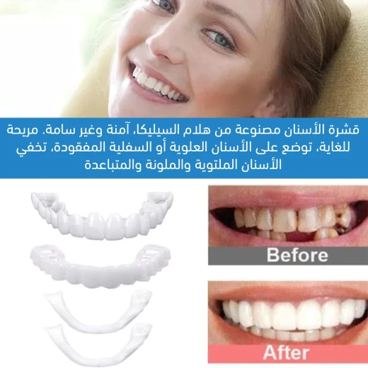 طقم فينير الأسنان المثالي, تغطية كاملة علوية وسفلية لابتسامة فورية وطبيعية تعزز الثقة - Image 4
