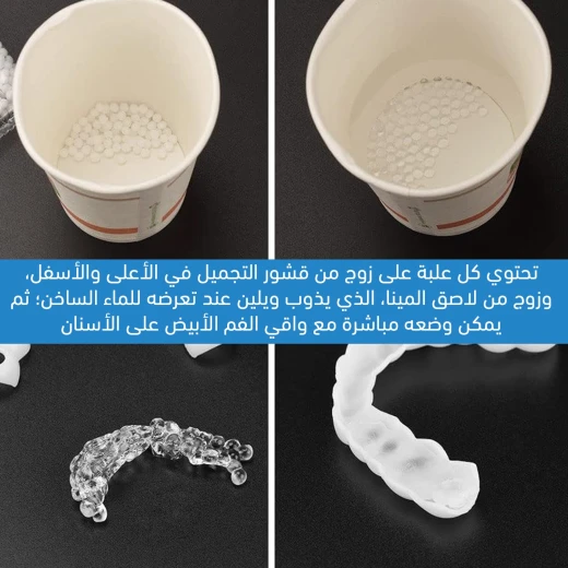 طقم فينير الأسنان المثالي, تغطية كاملة علوية وسفلية لابتسامة فورية وطبيعية تعزز الثقة - Image 5