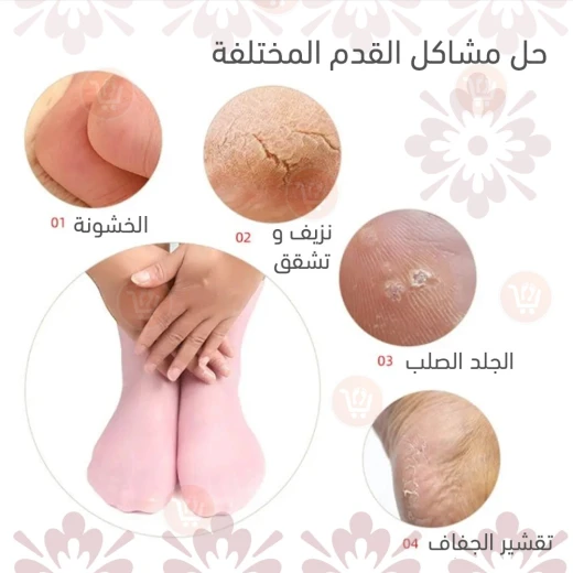 جوارب سيليكون مرطبة للقدمين الجافتين - زوج واحد - Image 5