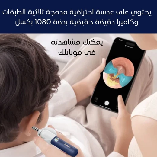 مجموعة تنظيف الأذن إيرسايت بلس D39R بكاميرا HD ,جهاز ذكي مزود بتطبيق وملعقة أذن آمنة, مناسب للكبار والأطفال من بيبيرد - بيبيرد - Image 4