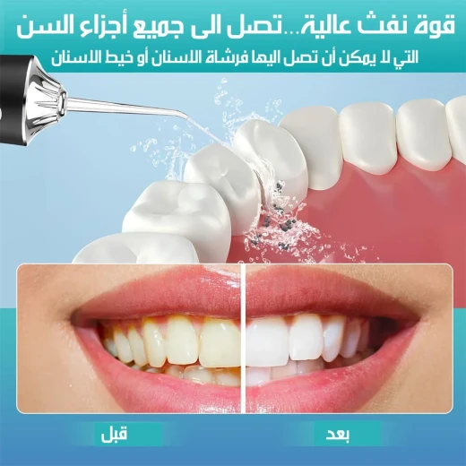 جهاز تنظيف الأسنان بالماء - Water flosser - Image 5