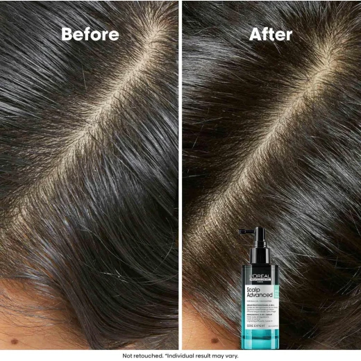 L'Oréal Professionnel |Scalp Advanced Anti-Oiliness 5 in 1 professional leave-in serum, defeats 5 scalp deregulation | SERIE EXPERT | 90ml - Loreal professionnel - Image 8