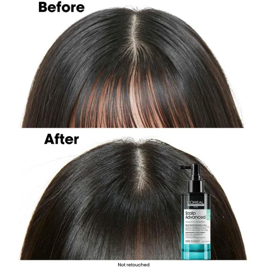 L'Oréal Professionnel |Scalp Advanced Anti-Oiliness 5 in 1 professional leave-in serum, defeats 5 scalp deregulation | SERIE EXPERT | 90ml - Loreal professionnel - Image 9