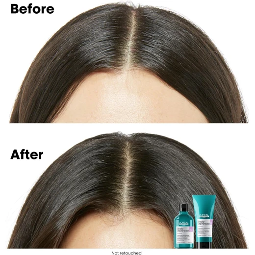 L’Oréal Professionnel│Scalp Advanced: Anti-discomfort Glacial Utopia Duo Set | Shampoo 300ml & Treatment 200ml | SERIE EXPERT - Loreal professionnel - Image 9