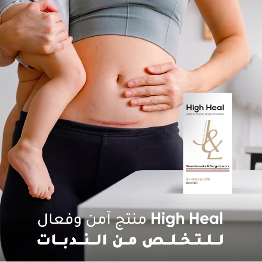 هاي هيل لعلامات التمدد و الجروح - هاي هيل - Image 2