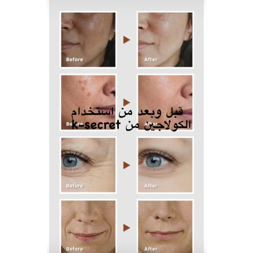 بلسم كولاجين فيتا سيكريت متعدد الاستخدامات للعناية بالتجاعيد وتفتيح البشرة، بني، 11 جرام، 10, ك-سكرت - ك-سيكرِت - Image 5