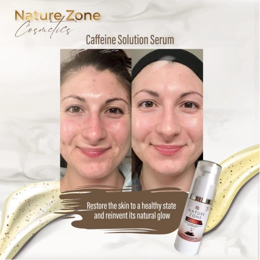 Nature Zone Revitalize Your Skin with Natural Caffeine Serum For Face & Under Eyes - Combat Acne, Dark Circles, Fine Lines, Wrinkles, Anti-Aging For Men & Women (1.06 Fl Oz) - nature zone - Image 5