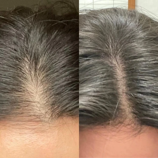 The Ordinary Multi-Peptide Serum for Hair Density 60ml Hair Growth & Thickness Booster with Redensyl & Caffeine Supports Scalp and Hair Health - The Ordinary - Image 4