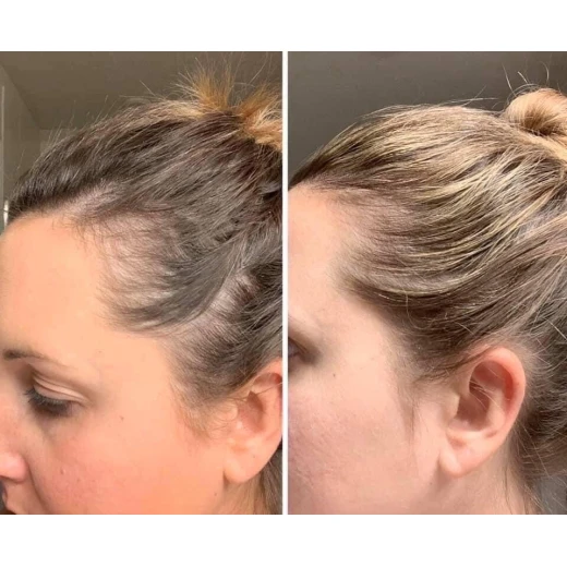 The Ordinary Multi-Peptide Serum for Hair Density 60ml Hair Growth & Thickness Booster with Redensyl & Caffeine Supports Scalp and Hair Health - The Ordinary - Image 5