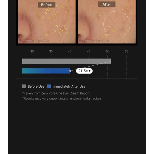 كريم ميديكوب زيرو بور اليومي 50 مل - مرطب خفيف الوزن لتقليل المسام، وترطيب البشرة، ومنحها نعومة وإشراقة صحية يومية - ميديكيوب - Image 2