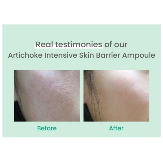 Axis-y Artichoke Intensive Skin Barrier Ampoule - 30ml - Axis-y - Image 2