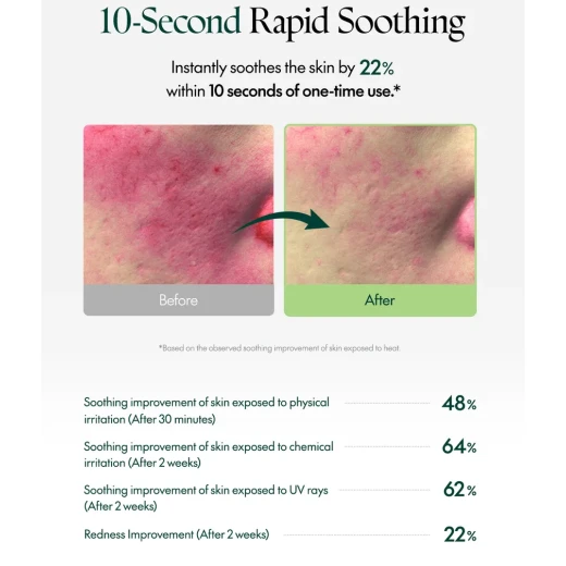 Purito SEOUL Wonder Releaf Centella Serum Unscented Instant Soothing, Redness Relief & Skin Barrier Care - PURITO - Image 8