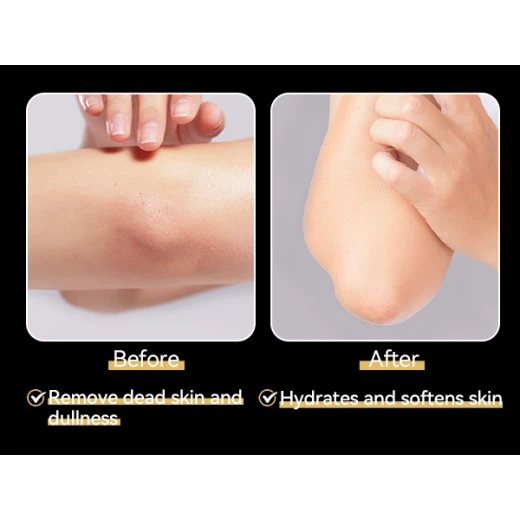 lanbena exfoliating peeling spray - LANBENA - Image 2
