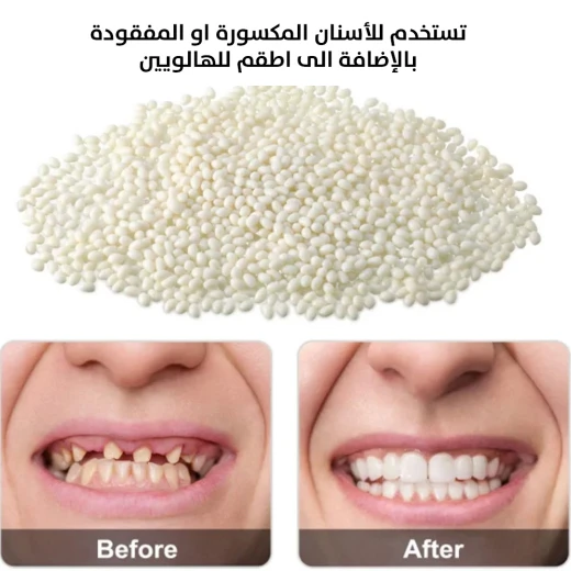 معجون حشوات الراتنج للأسنان عدد واحد - Image 4
