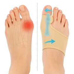 Orthopedic Bunion Corrector Toe Aligner – Pain Relief & Prevention Support for Big Toe Joint